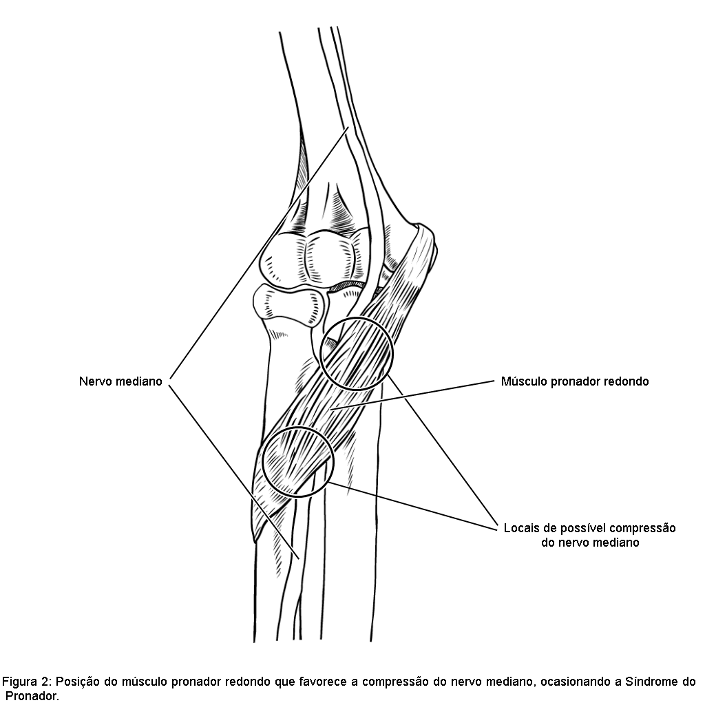 Desordens musculoesqueléticas do cotovelo nas academias de ginástica –  Anatomia \u0026 Fisioterapia, image size:1024x1024
