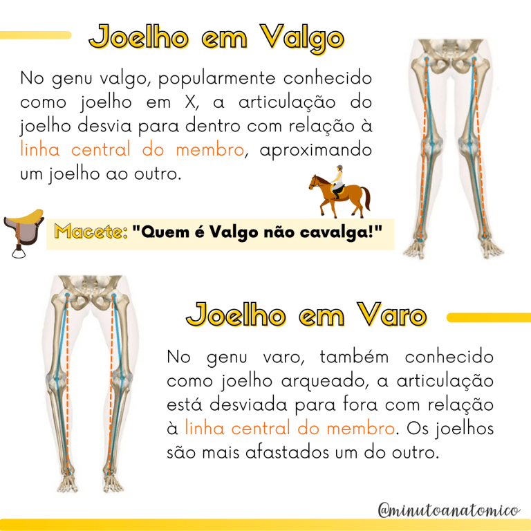 minuto-anatomocl-nico-12-joelho-em-valgo-e-varo-anatomia-fisioterapia