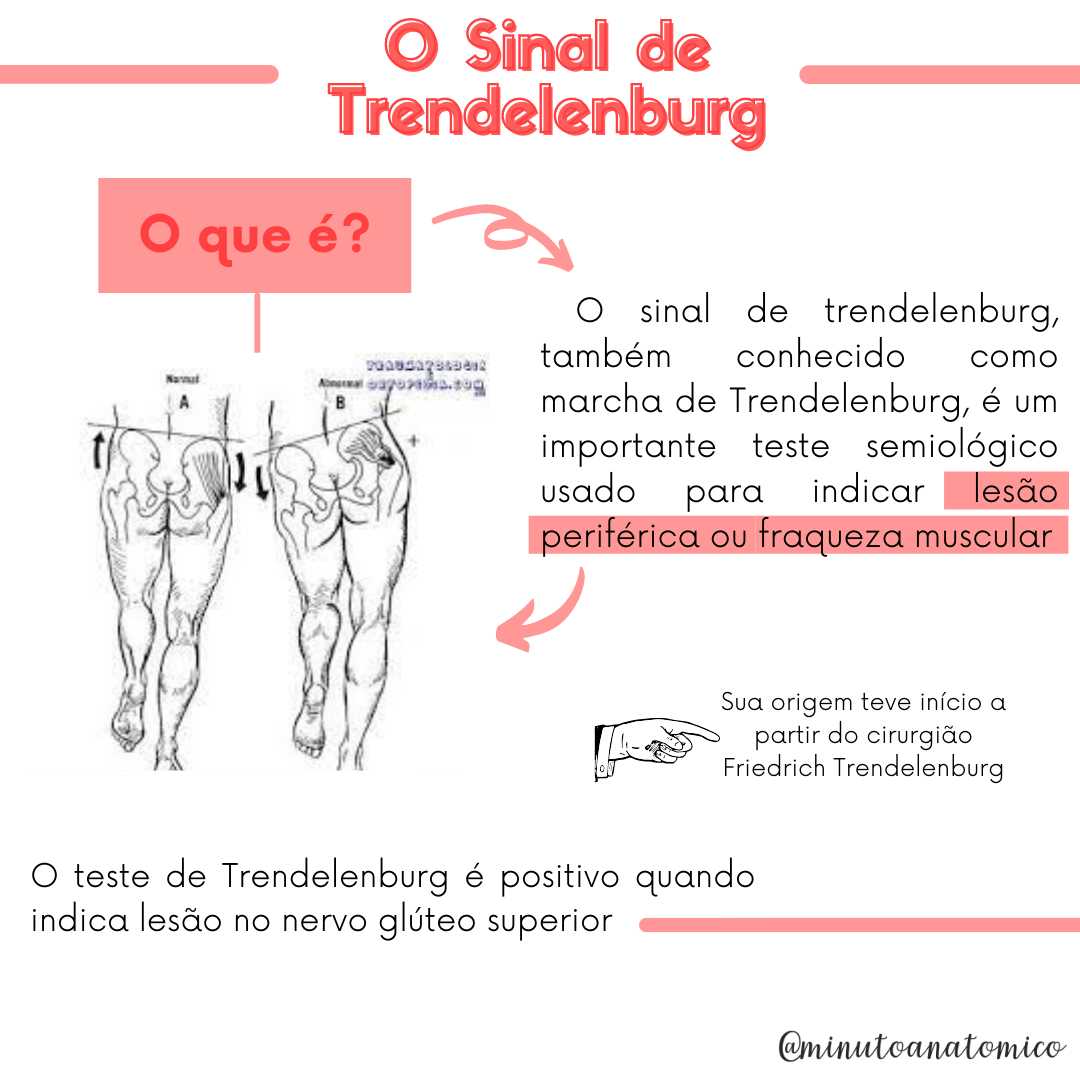Minuto Anatomocl nico 15 Marcha De Trendelenburg Anatomia Minuto Anatomocl nico 15 Marcha De Trendelenburg Anatomia