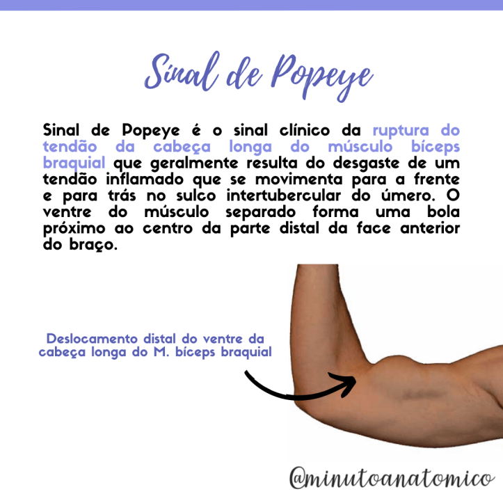 Minuto Anatomocl nico 19 Sinal Do Popeye Anatomia Fisioterapia minuto-anatomocl-nico-19-sinal-do-popeye-anatomia-fisioterapia