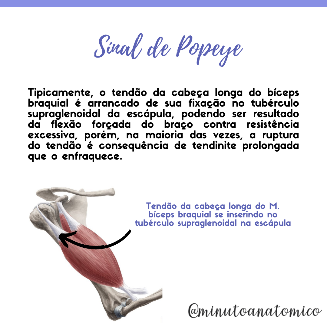 Minuto Anatomocl nico 19 Sinal Do Popeye Anatomia Fisioterapia minuto-anatomocl-nico-19-sinal-do-popeye-anatomia-fisioterapia
