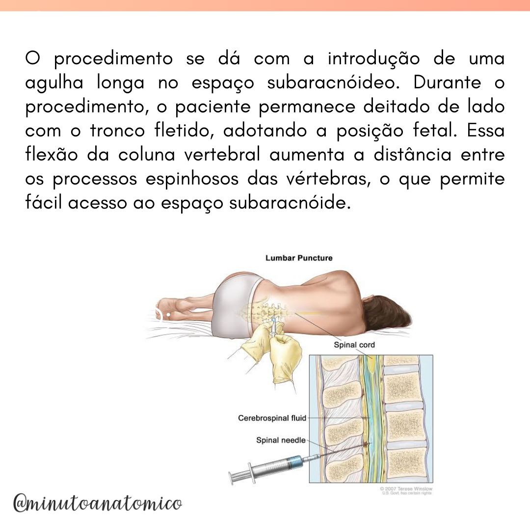 Minuto Anatômico #184: Punção Lombar – Anatomia & Fisioterapia